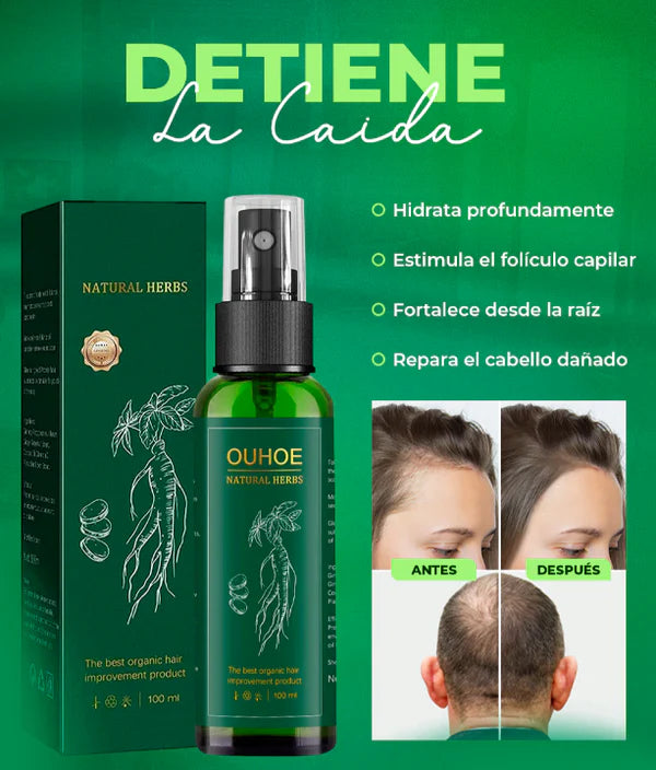 ELIXIR OUHOE CAPILAR - Tratamiento Natural para Crecimiento y Control de Caída de Cabello